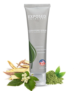 Clear Pore Serum – Banish Blackheads & Reduce Shine with 1% Salicylic Acid for Sensitive Skin