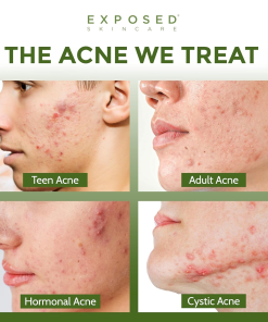 Alternative view of Clear Pore Serum – Banish Blackheads & Reduce Shine with 1% Salicylic Acid for Sensitive Skin