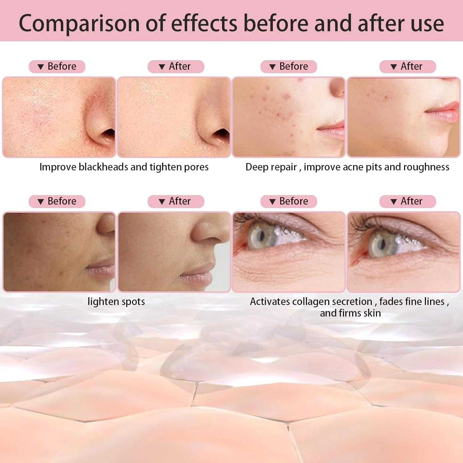 LED Face Mask – Fight Acne & Breakouts with 7-Color Light Therapy - Image 7